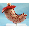 Human Stomach with Ulcers Anatomical Model